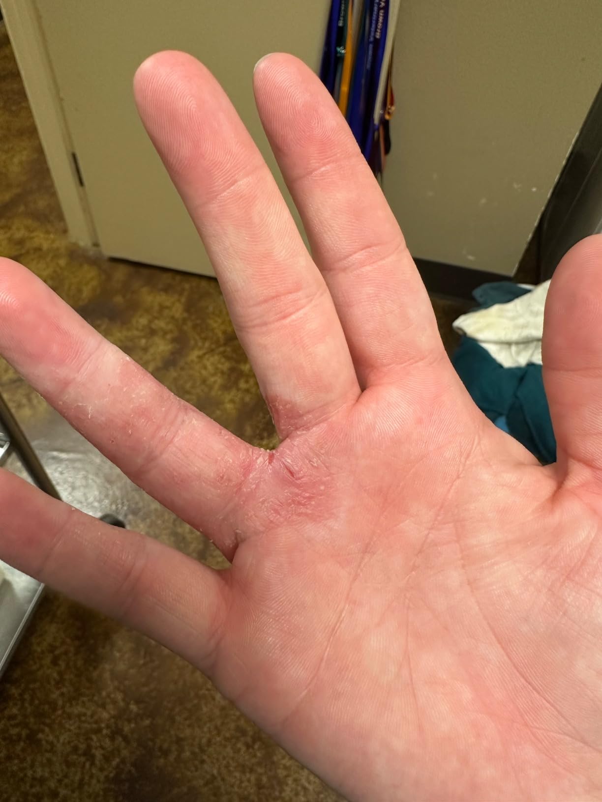 Gloves In A Bottle Shielding Lotion - Protective Barrier Hand Lotion for Dry, Cracked Hands, Non-Greasy Moisturizer, 2 oz customer photo 2