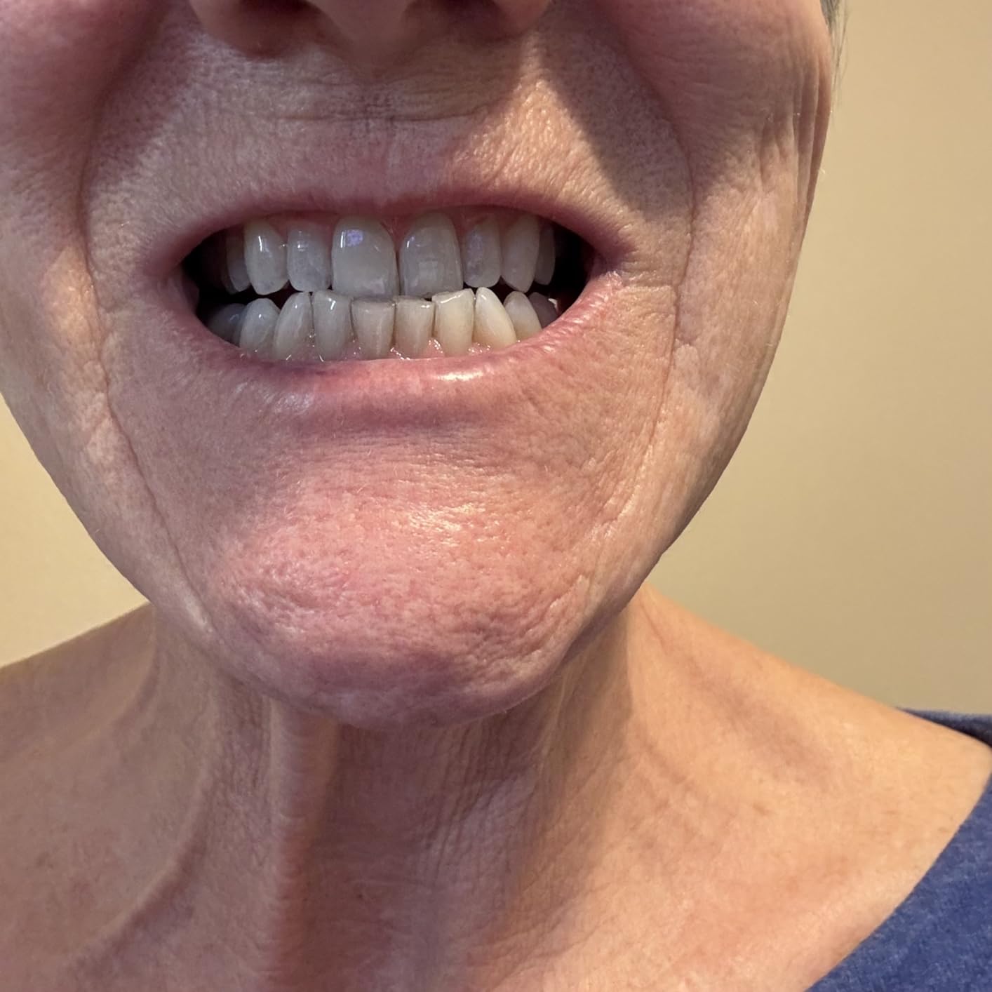Plus White Speed Whitening Gel, 5 MinuteTeeth Whitening (2 oz) customer photo 1