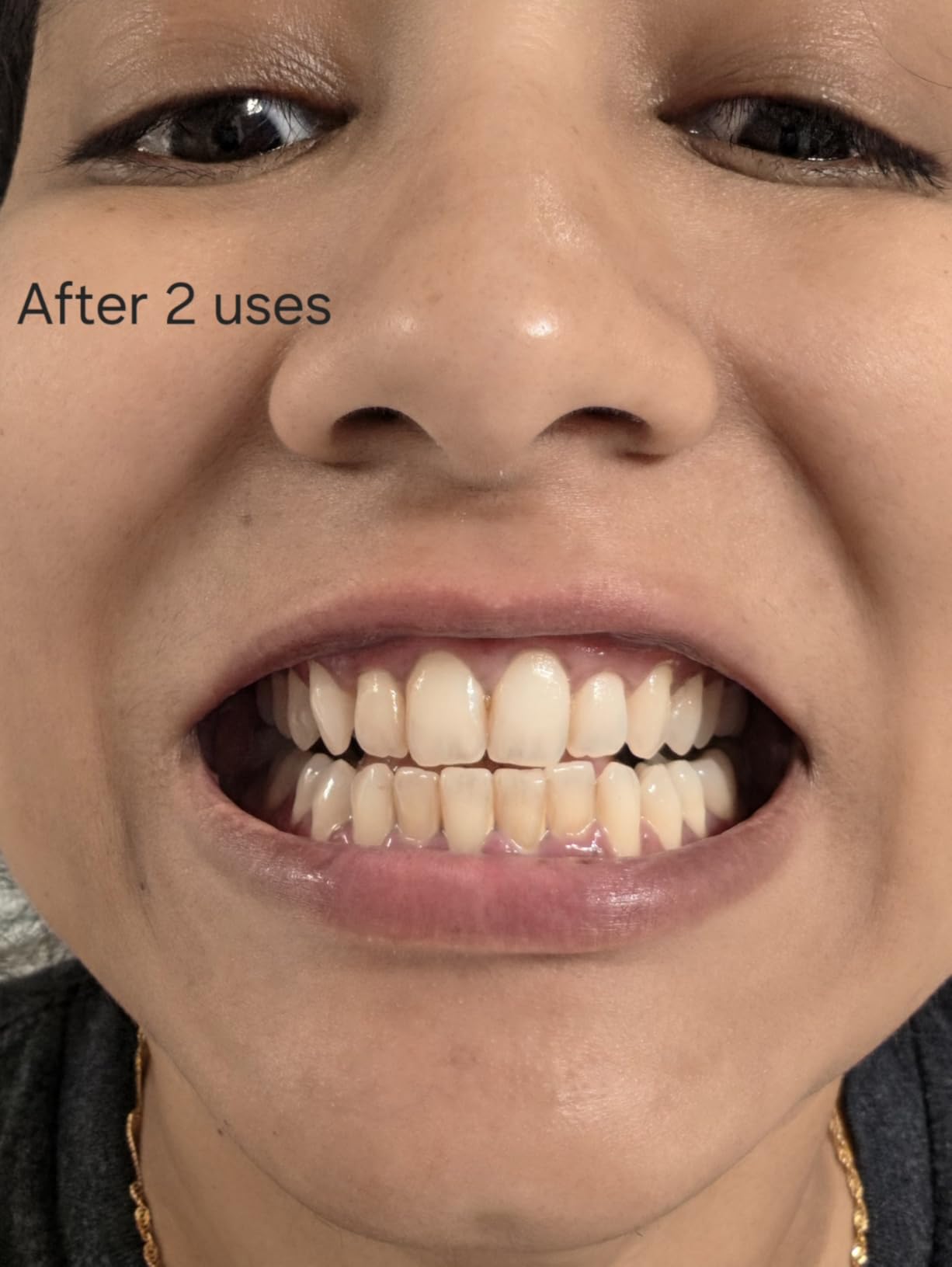 Plus White Speed Whitening Gel, 5 MinuteTeeth Whitening (2 oz) customer photo 2
