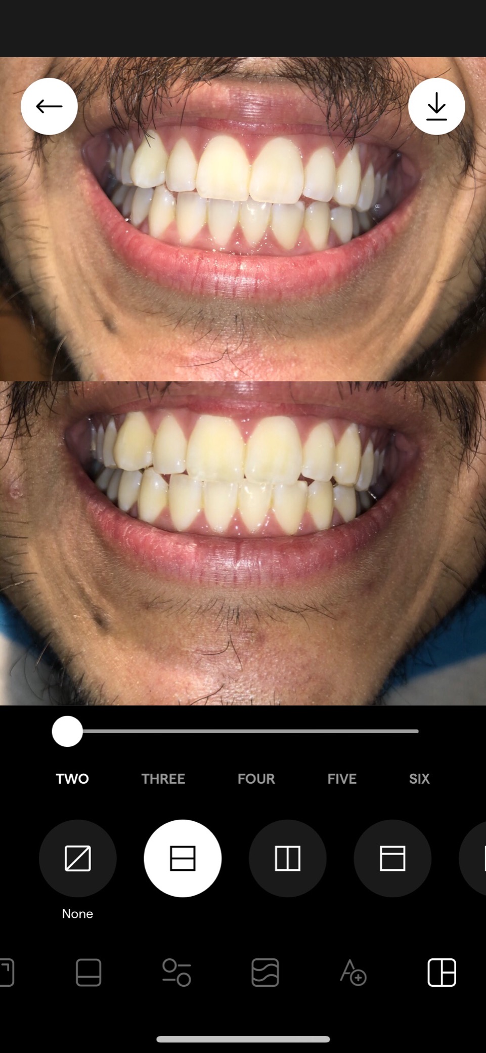 Crest 3D Whitestrips Express Whitening with Light, Whitestrips 3D White, Teeth Whitening Strip Kit, 20 Strips (10 Count Pack), Crest Teeth Whitening Strips, Teeth Whitening Kit customer photo 1