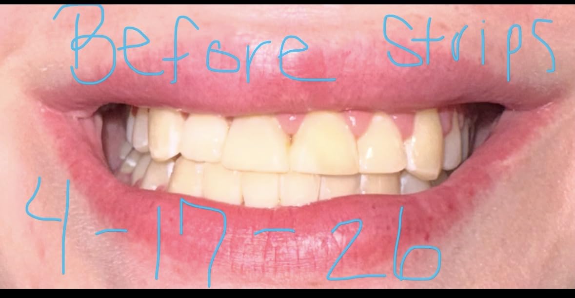 Crest Teeth Whitening Strips, Crest 3D Whitestrips Vivid Plus, Enamel Safe Teeth Whitening Kit, 12 Treatments (24 Strips), Visibly Whitens in Days, 8 Levels Whiter customer photo 2