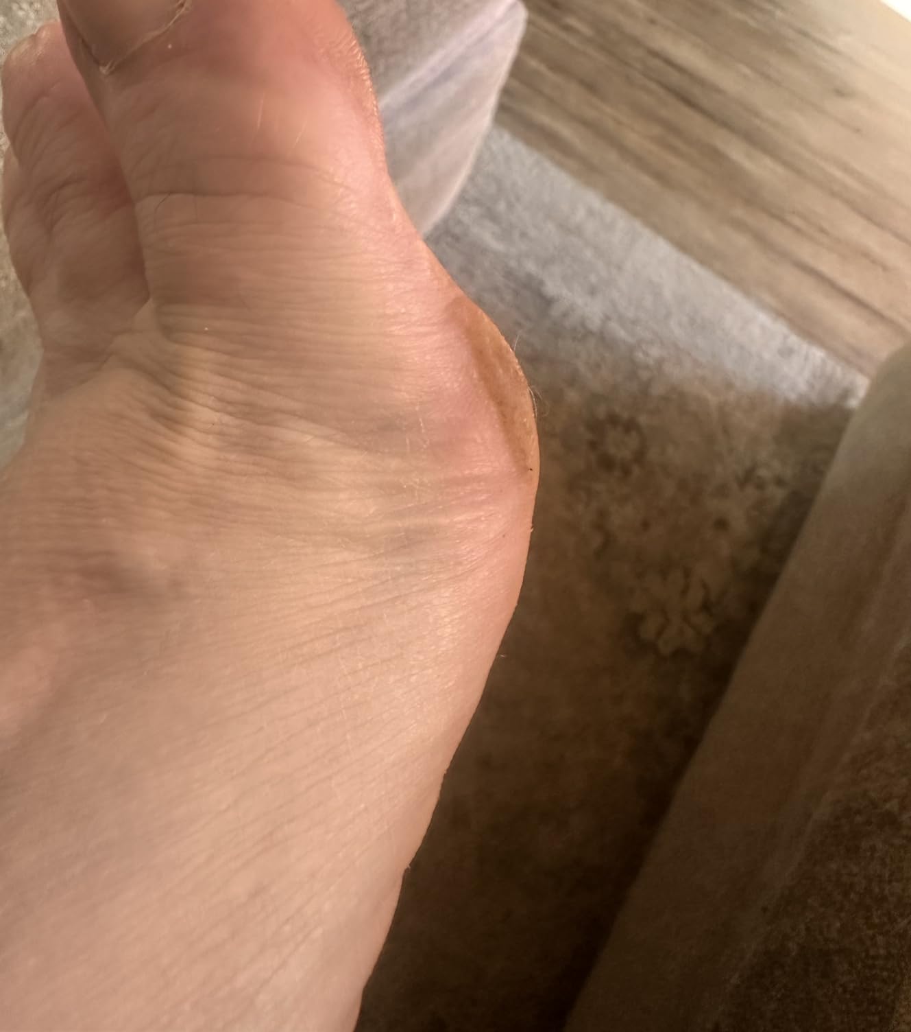Electric Foot Callus Remover, Rechargeable Foot File for Dead Skin Care customer photo 2