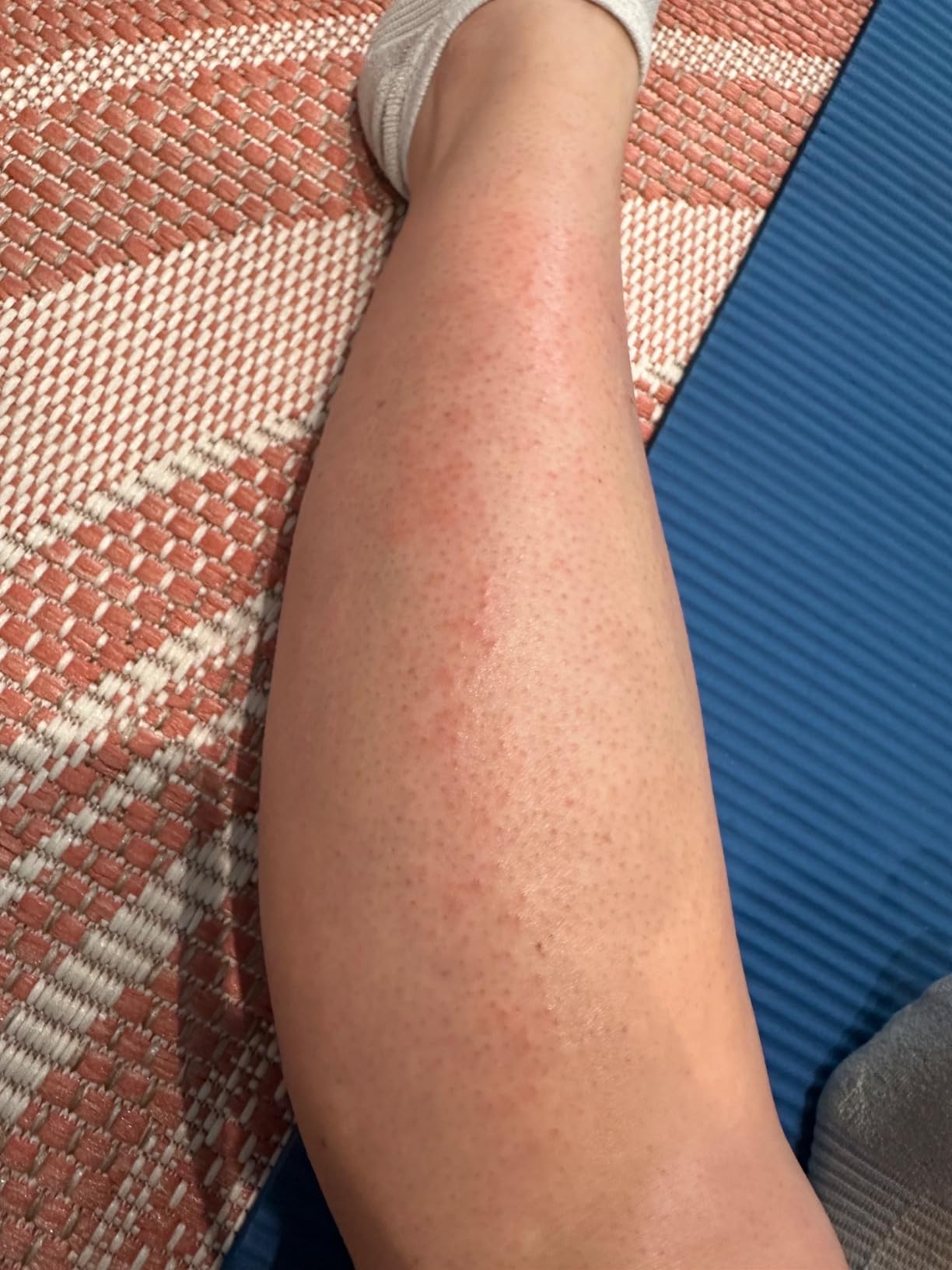 Braun IPL, Silk·Expert Pro 5, IPL Hair Removal for Women and Men, Permanent Laser Hair Reduction At-Home, 2 Heads, Pouch, IPL5137 customer photo 1