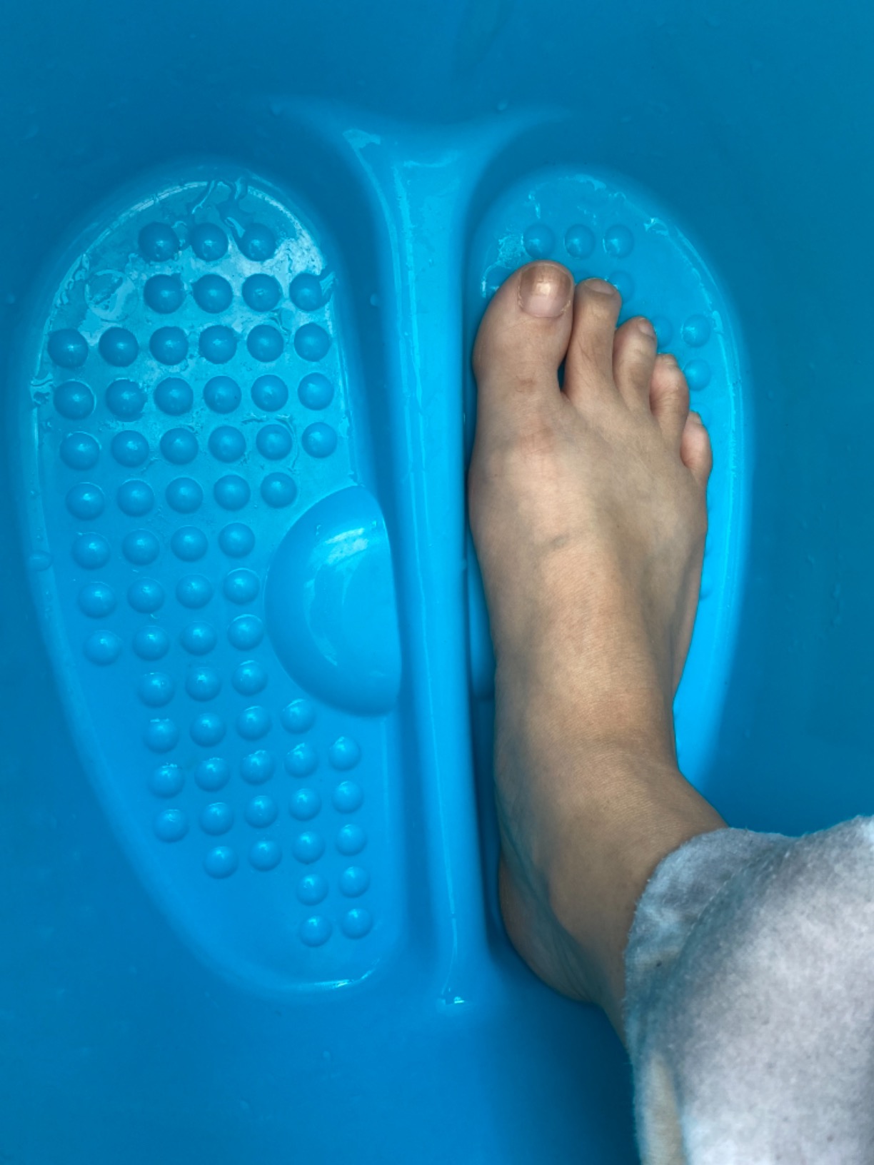 AllSett Health Foot Soaking Bath Basin – Large Size for Soaking Feet | Pedicure and Massager Tub for at Home Spa Treatment | Callus, Fungus, Dead Skin Remover, Blue customer photo 2