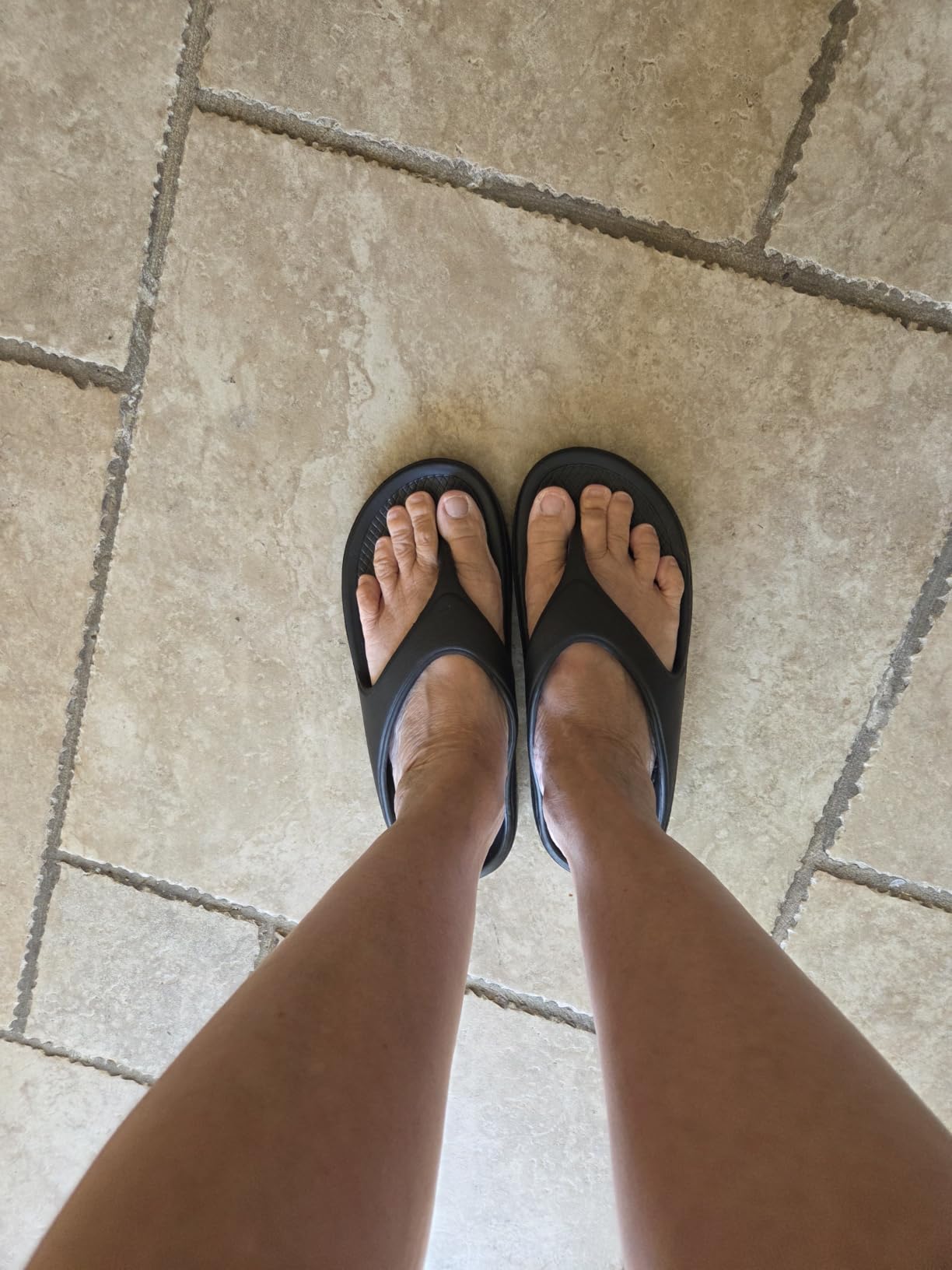 shevalues Orthopedic Sandals for Women, Arch Support Recovery Flip Flops customer photo 2