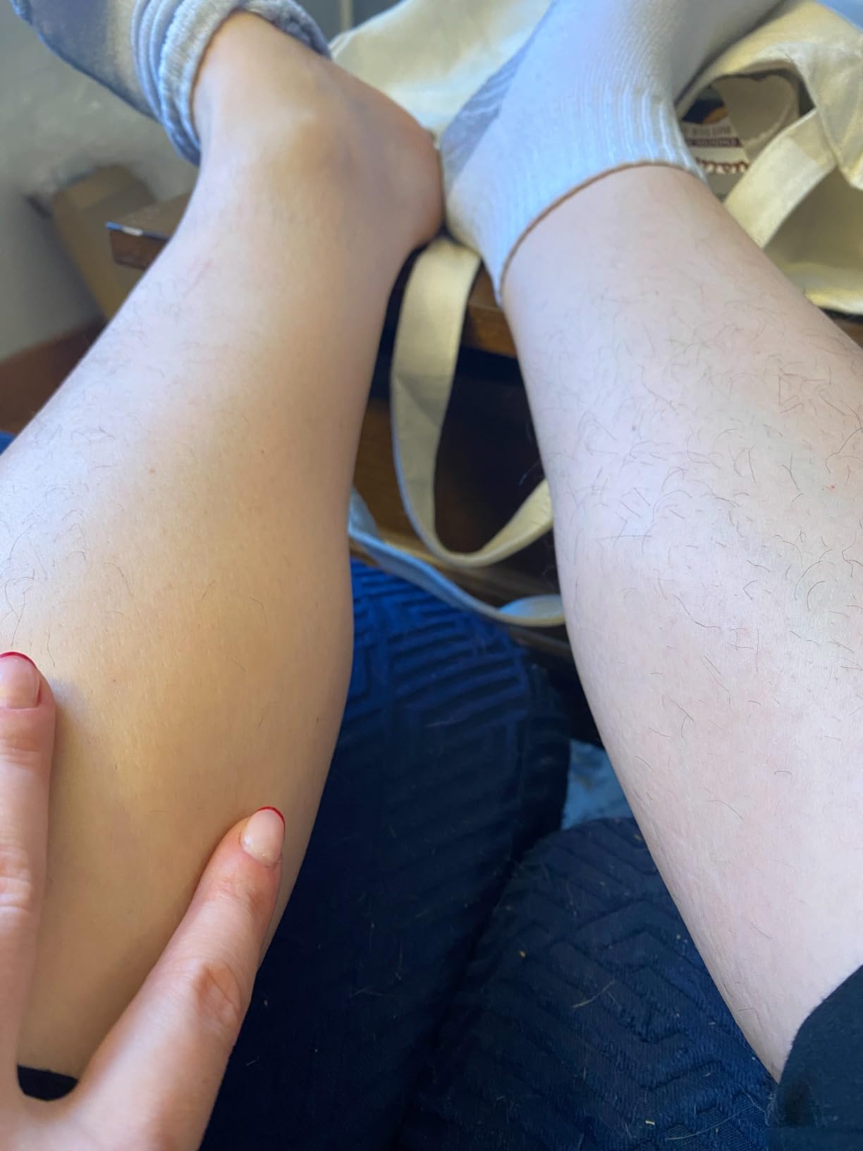 JOVS Laser Hair Removal, IPL Hair Removal for Women and Men, 37°F Painless Sapphire Ice-Cooling Tech, 6 Modes for Whole Body Hair Removal Device, 2 in 1 Skin Rejuvenation, 330° Rotation customer photo 2