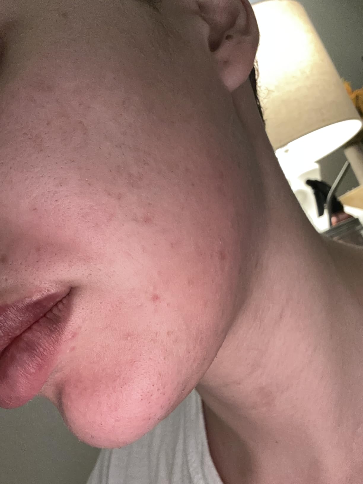 Radio Frequency Skin Tightening Device, Anti-Aging Face Machine for Wrinkle Removal, Lifting & Firming, Wireless Home Beauty Device with 3 Levels, at-Home Skin Renewal customer photo 1