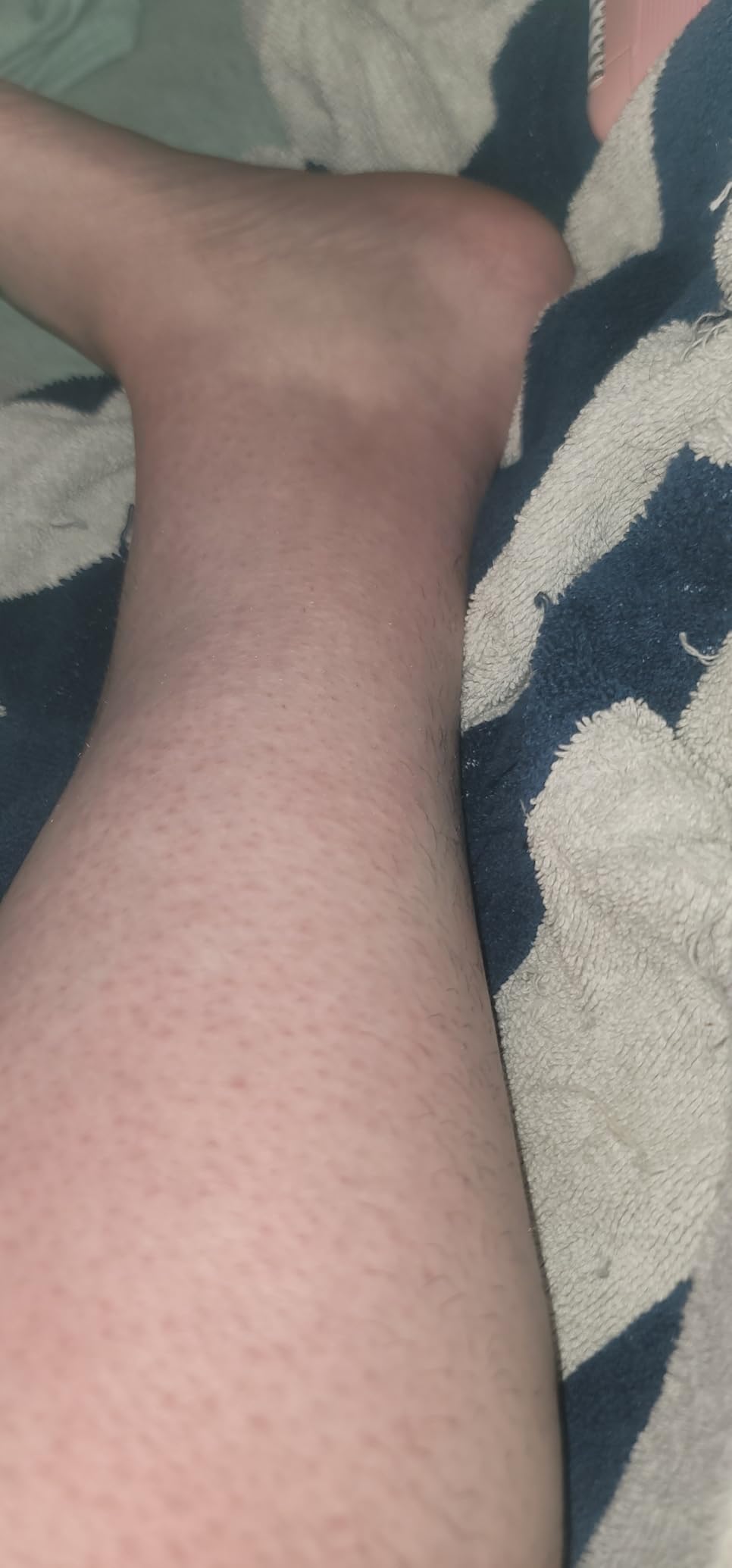 Philips Epilator Series 2000, Corded Epilator for Legs and Body, Hair Removal Device for Women, Model BRE227/00 customer photo 1