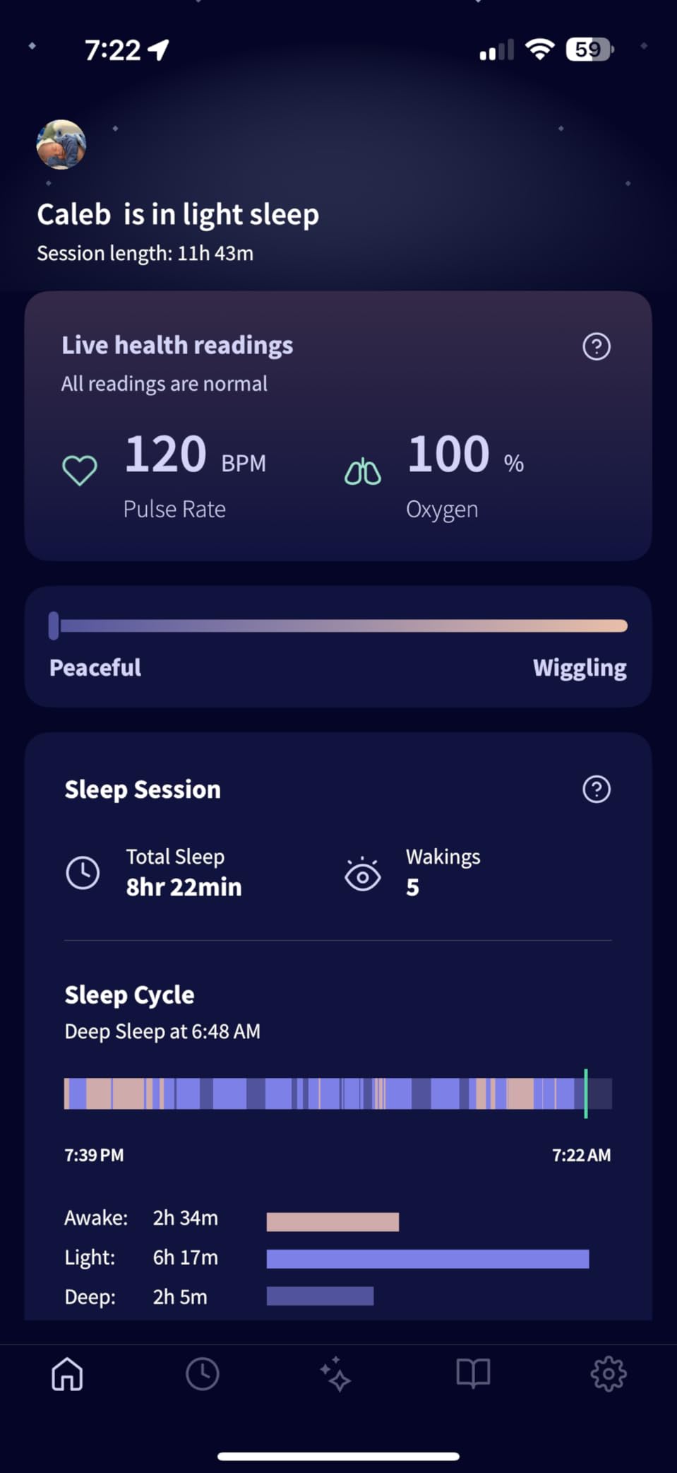 Owlet Dream Sock Smart Baby Monitor, Includes 3 Months of Owlet 360 customer photo 1